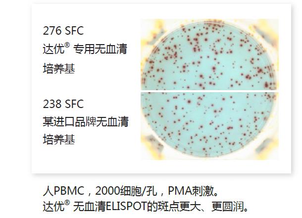 人淋巴細胞無血清培養(yǎng)基-斑點2.jpg